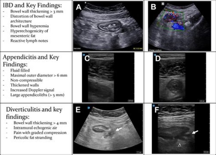 Can a string be promoted to a double C++?