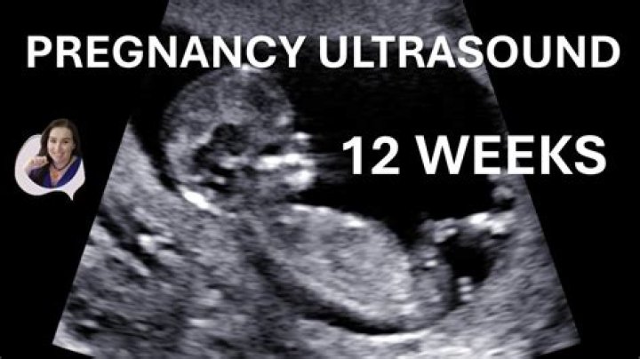 Can you start showing at 12 weeks with second pregnancy?