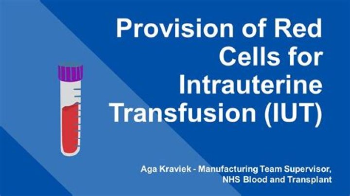 How do you intrauterine a blood transfusion?