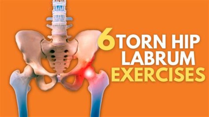 Is stretching good for a torn hip labrum?
