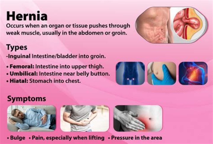 What are the symptoms of a hernia in the groin?