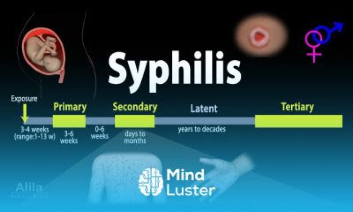 What does neurosyphilis feel like?