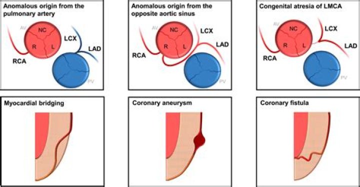 What is the importance of the left main stem artery?