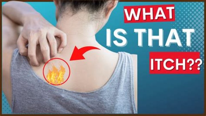 What to do if the back of your head is itchy?
